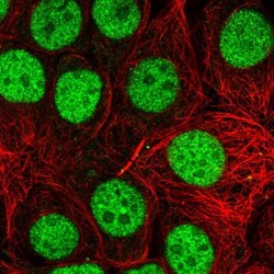 TRBP Antibody, Novus Biologicals:Antibodies:Primary Antibodies